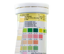 Urinalysis - image